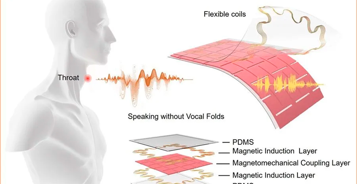 Universidad de California desarrolla un parche para recuperar el habla sin necesidad de usar las cuerdas vocales