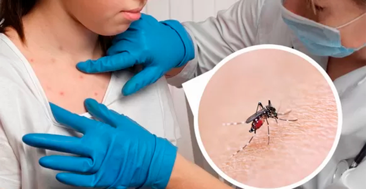 Aumentan un 385% los casos de dengue en México; muertes se quintuplican