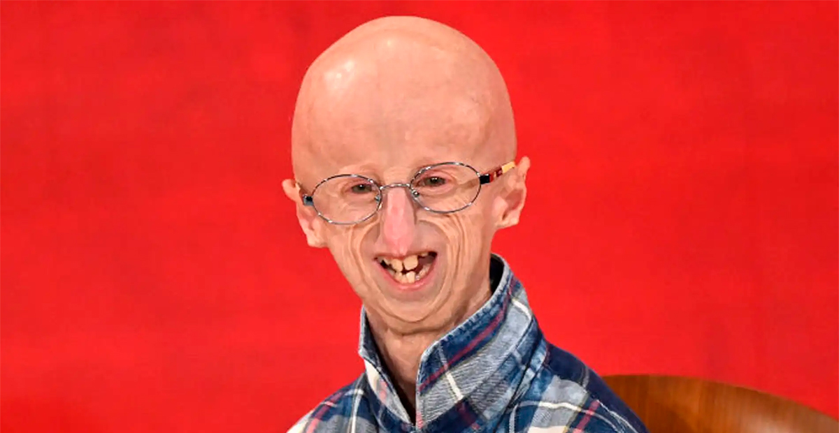 Fallece Sammy Basso, el científico italiano que visibilizó la progeria, a los 28 años