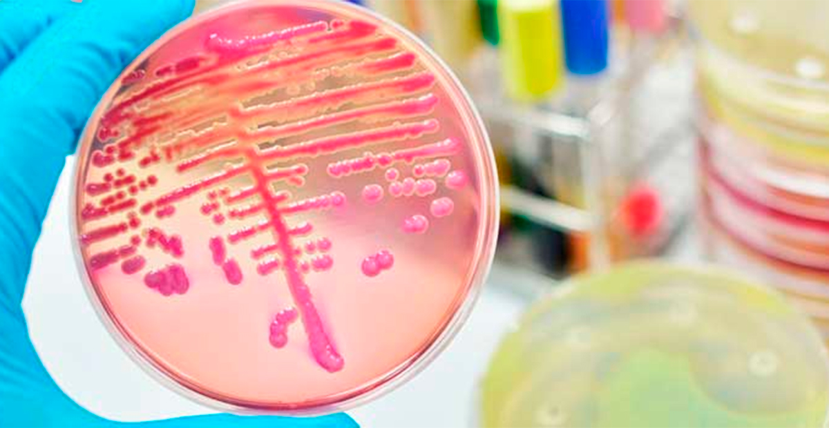 Alerta epidemiológica en el Estado de México por brote de bacteria Klebsiella oxytoca