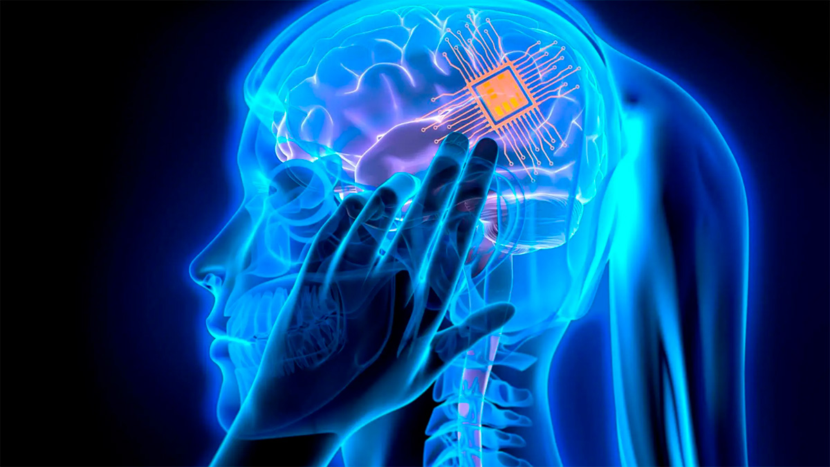 China avanza en la carrera de los chips cerebrales: implantará Beinao No.1 en 13 pacientes este año