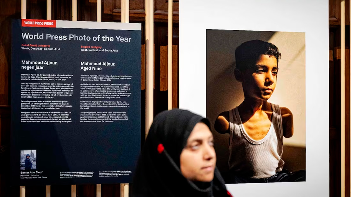 Fotografía de niño palestino herido en Gaza gana el World Press Photo 2025