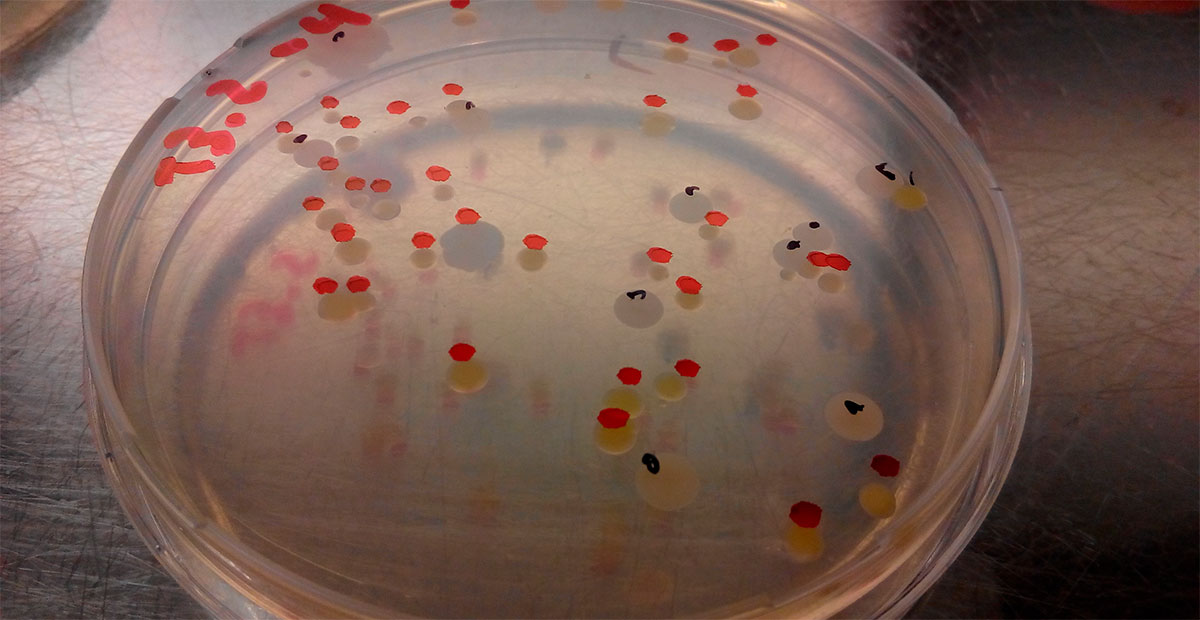 Descubren que una bacteria intestinal puede transformar residuos plásticos en paracetamol