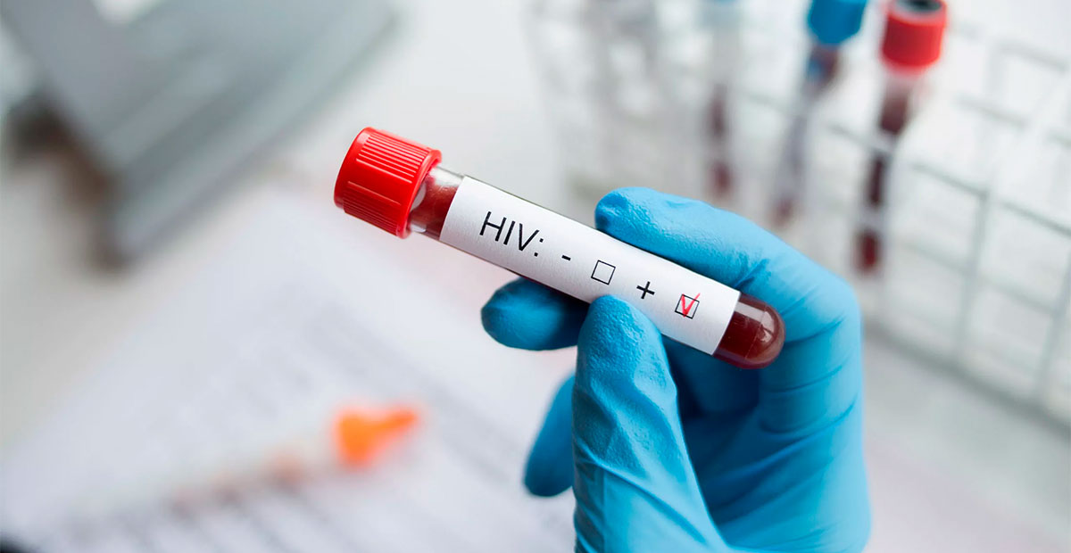 EE.UU. aprueba revolucionario tratamiento inyectable para prevenir el VIH