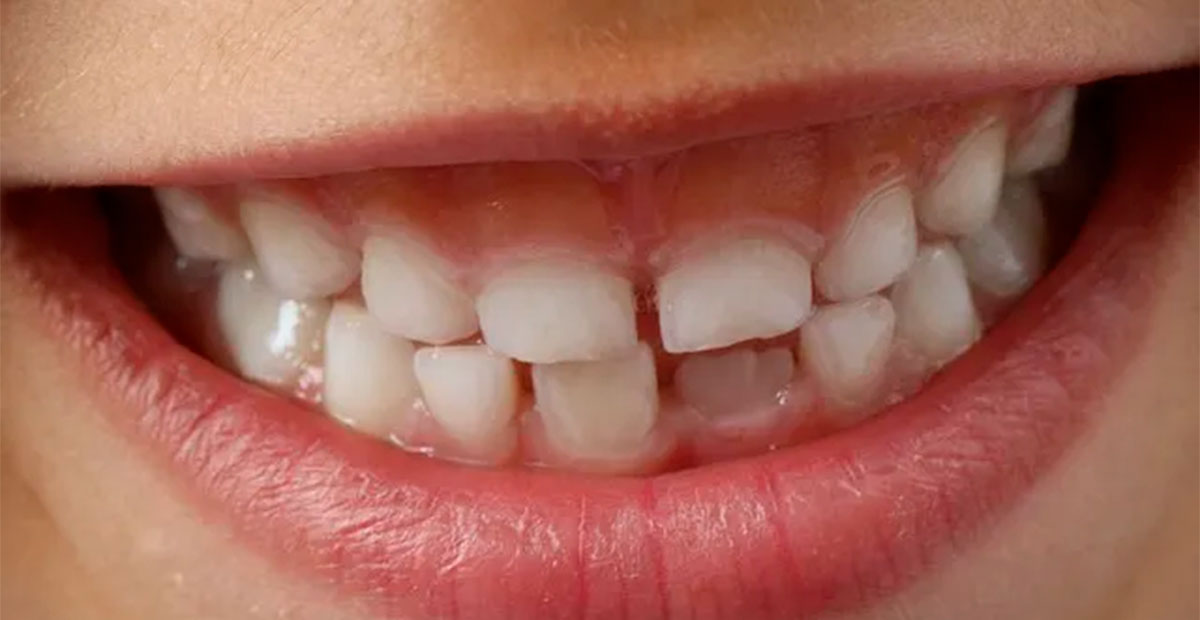 Científicos británicos logran cultivar dientes humanos en laboratorio