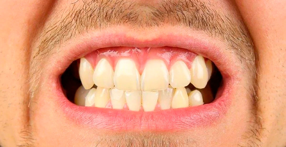 Científicos logran cultivar dientes humanos en laboratorio