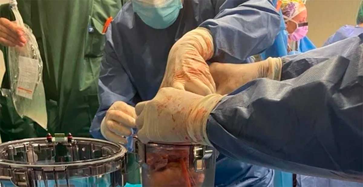 Irlanda aprueba ley que convierte a todos los adultos en donantes de órganos por defecto