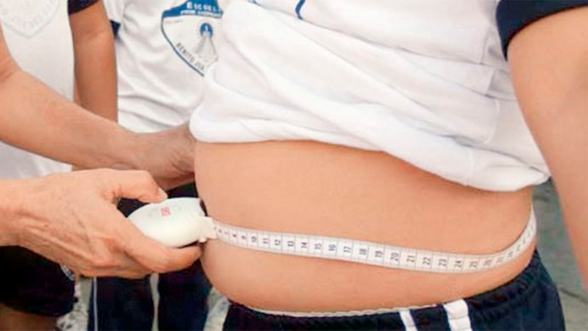 Obesidad infantil supera al bajo peso por primera vez en el mundo: UNICEF lanza alerta global