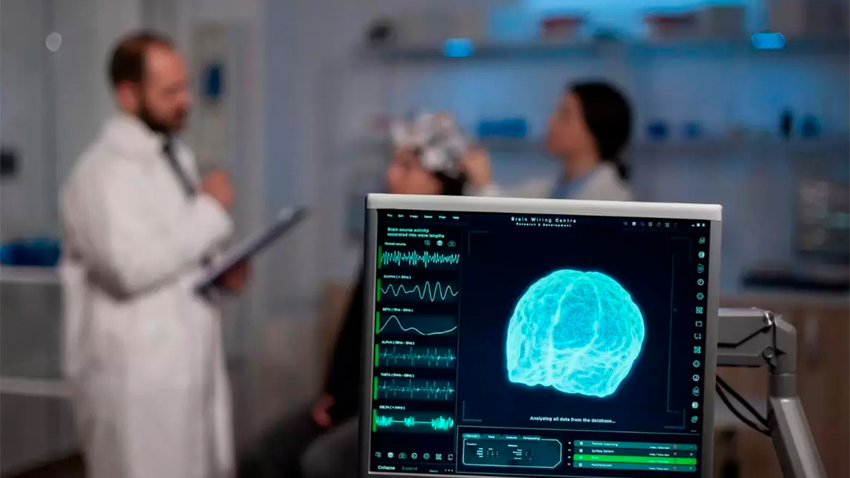 Inteligencia artificial detecta malformaciones cerebrales invisibles para resonancias magnéticas