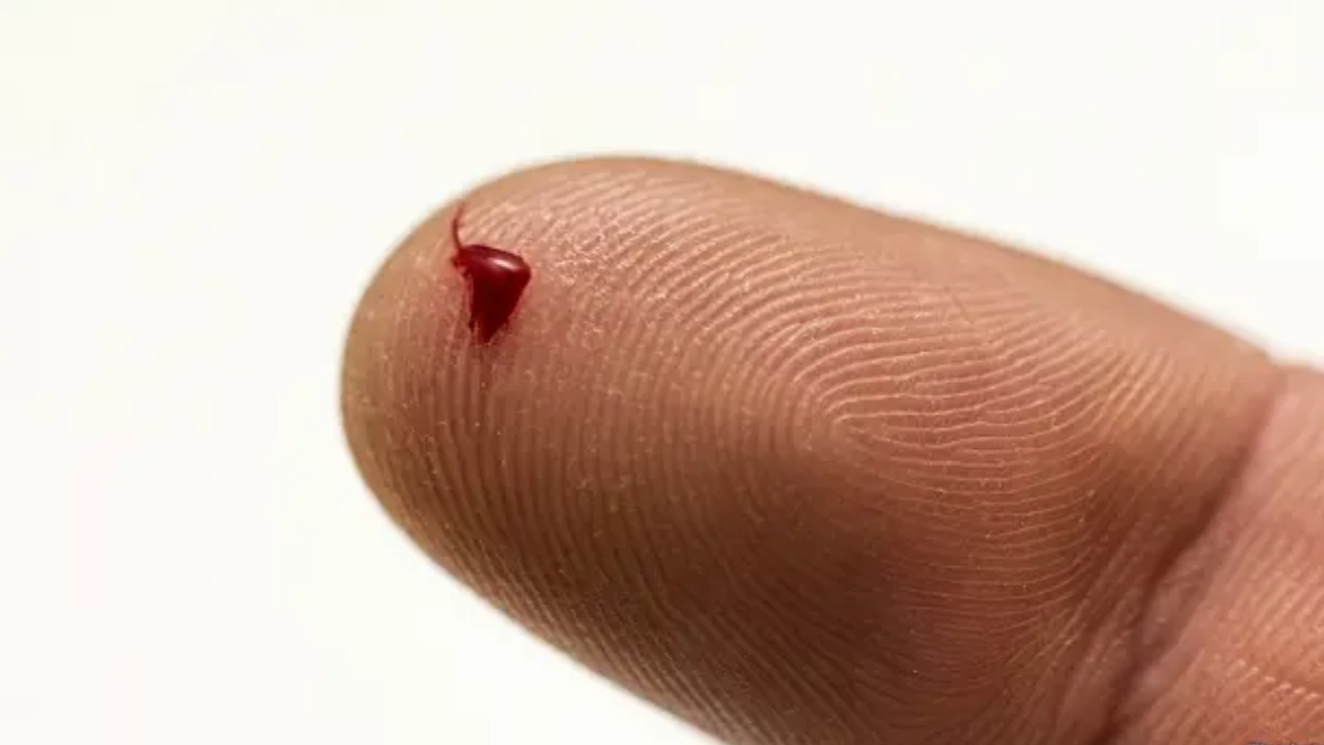 Una gota de sangre podría revolucionar el diagnóstico temprano del Alzheimer