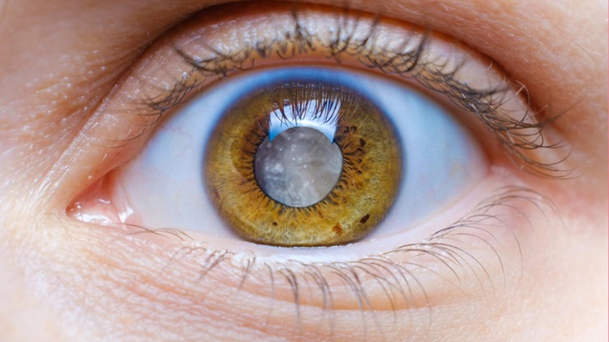 Científicos de la UNAM desarrollan gotas que podrían prevenir la ceguera por diabetes