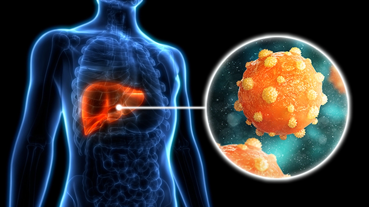 Nuevo fármaco logra “cura funcional” contra hepatitis B en pacientes crónicos
