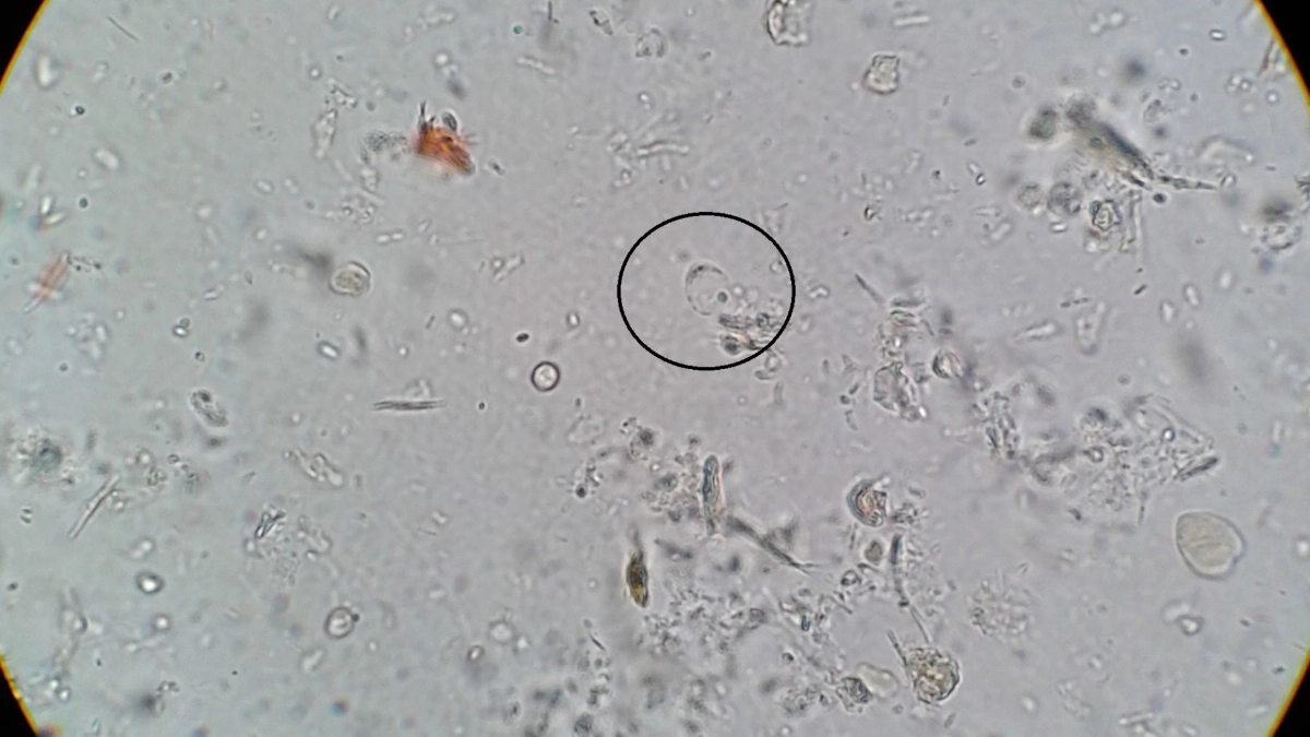 Microorganismo intestinal podría ayudar a regular la glucosa y favorecer un envejecimiento más saludable