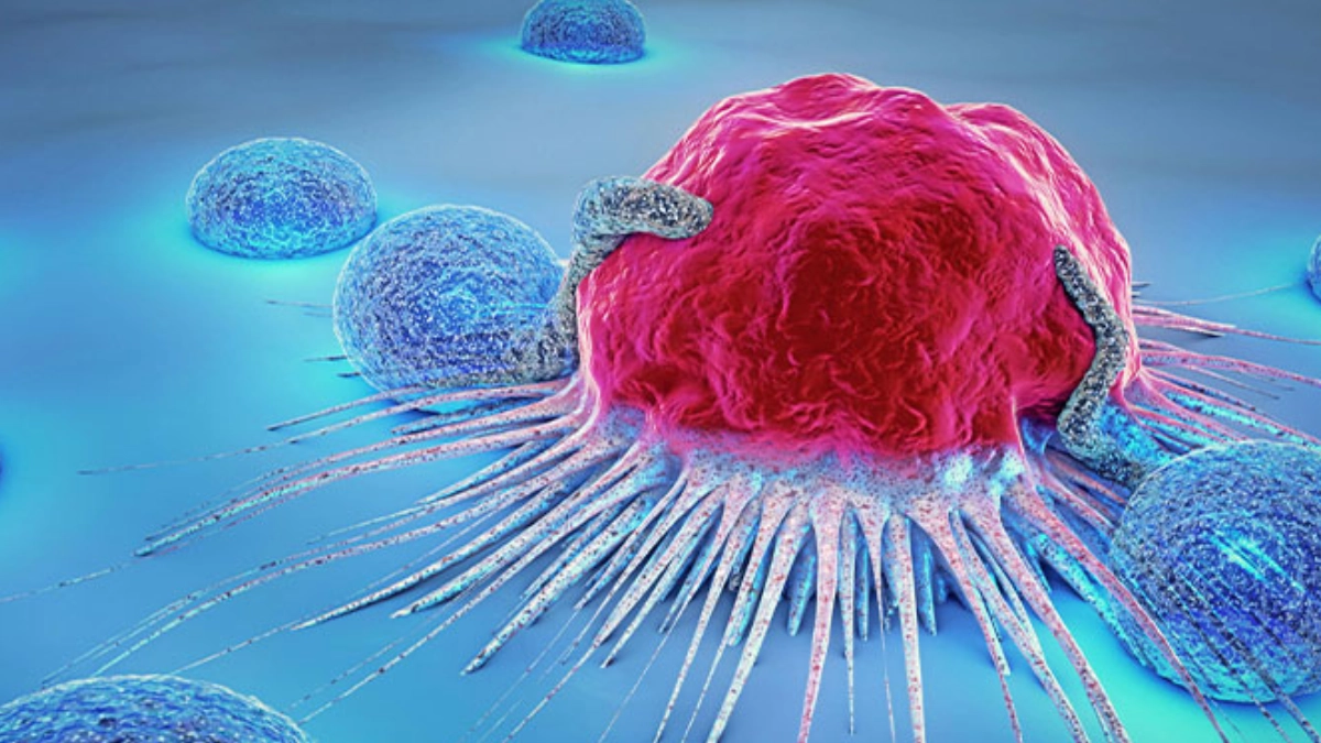 OMS alerta que uno de cada cinco habitantes desarrollará cáncer y los casos aumentarán 70% hacia 2050