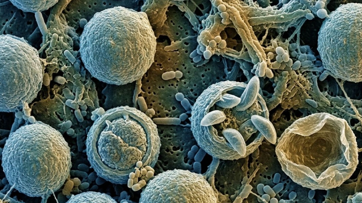 Confirman dos muertes vinculadas al brote de ciclosporiasis en Michigan; contagios continúan en aumento