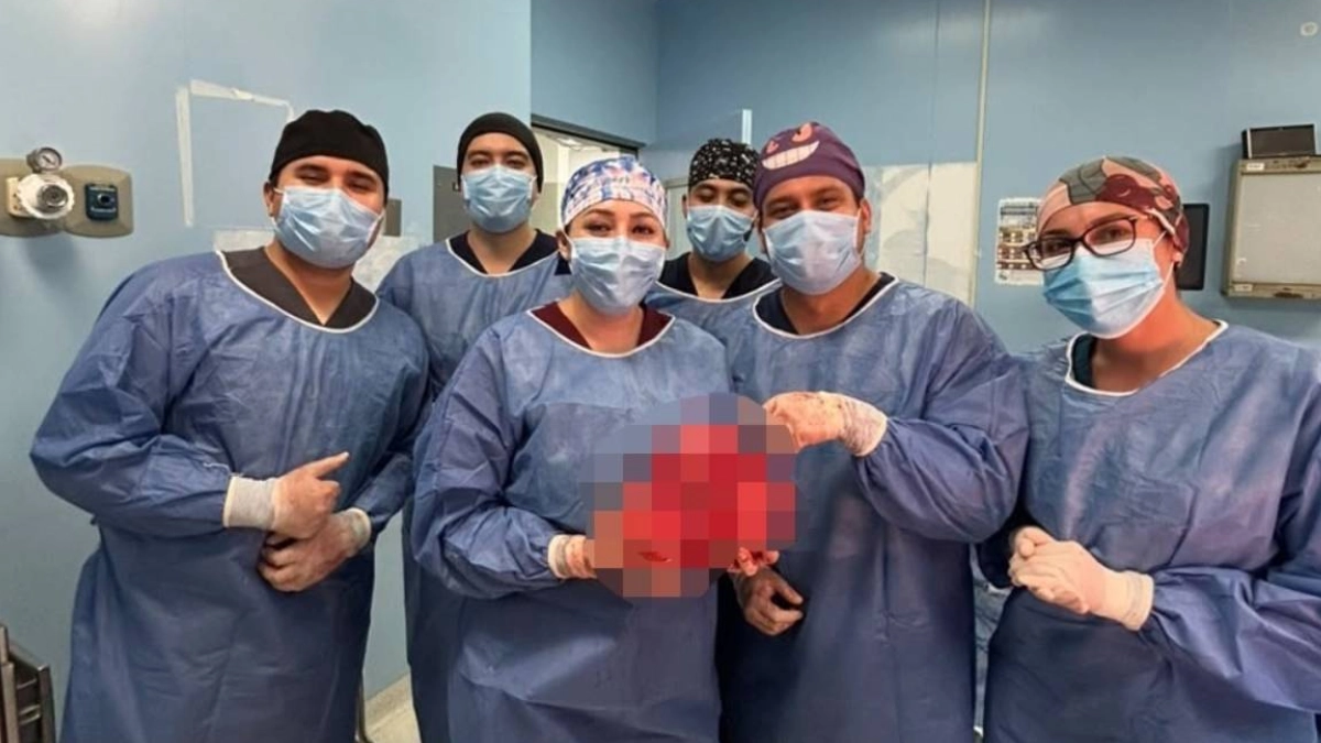 ISSSTE extirpa tumor abdominal de cuatro kilos en Baja California Sur